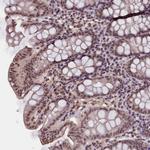 ZC3H4 Antibody in Immunohistochemistry (Paraffin) (IHC (P))