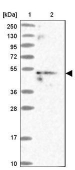 MKKS Antibody in Western Blot (WB)