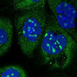 KNOP1 Polyclonal Antibody