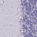 KNOP1 Antibody in Immunohistochemistry (Paraffin) (IHC (P))