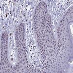 KNOP1 Antibody in Immunohistochemistry (Paraffin) (IHC (P))