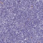 KNOP1 Antibody in Immunohistochemistry (Paraffin) (IHC (P))