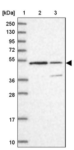 KNOP1 Antibody in Western Blot (WB)