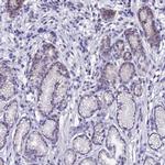 KNOP1 Antibody in Immunohistochemistry (IHC)