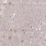 WDR59 Antibody in Immunohistochemistry (Paraffin) (IHC (P))