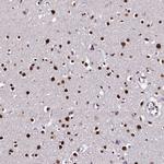 CPSF7 Antibody in Immunohistochemistry (Paraffin) (IHC (P))