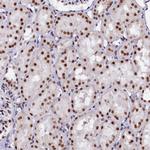 CPSF7 Antibody in Immunohistochemistry (Paraffin) (IHC (P))
