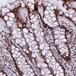 CPSF7 Antibody in Immunohistochemistry (Paraffin) (IHC (P))