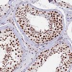 CPSF7 Antibody in Immunohistochemistry (Paraffin) (IHC (P))