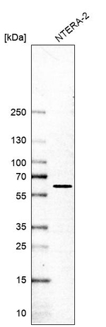 CPSF7 Antibody in Western Blot (WB)