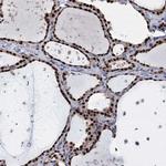 TSEN34 Polyclonal Antibody