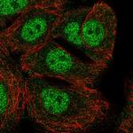 GFOD2 Polyclonal Antibody