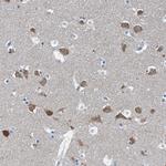 GFOD2 Antibody in Immunohistochemistry (Paraffin) (IHC (P))