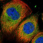 CP045 Polyclonal Antibody