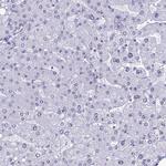 CCDC86 Antibody in Immunohistochemistry (Paraffin) (IHC (P))