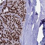 CCDC86 Antibody in Immunohistochemistry (IHC)