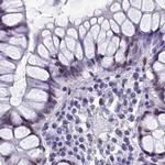 CCDC86 Antibody in Immunohistochemistry (IHC)