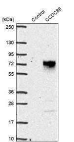 CCDC86 Antibody in Western Blot (WB)