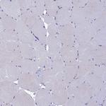 KCTD14 Antibody in Immunohistochemistry (IHC)