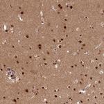 ADIG Polyclonal Antibody