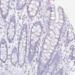 ZG16B Antibody in Immunohistochemistry (IHC)