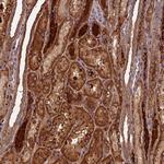 CP070 Antibody in Immunohistochemistry (Paraffin) (IHC (P))