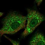 CPNE2 Polyclonal Antibody