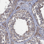 CTU2 Antibody in Immunohistochemistry (Paraffin) (IHC (P))