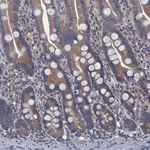 CTU2 Antibody in Immunohistochemistry (Paraffin) (IHC (P))