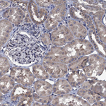 CTU2 Antibody in Immunohistochemistry (Paraffin) (IHC (P))