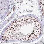 MOSPD3 Antibody in Immunohistochemistry (Paraffin) (IHC (P))
