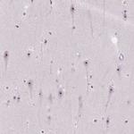 CIRH1A Polyclonal Antibody