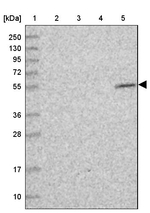 CIRH1A Antibody in Western Blot (WB)