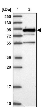 EPS8L2 Antibody in Western Blot (WB)