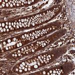 RPUSD1 Antibody in Immunohistochemistry (Paraffin) (IHC (P))