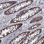 PPP1R3D Polyclonal Antibody