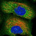 ZSWIM1 Polyclonal Antibody