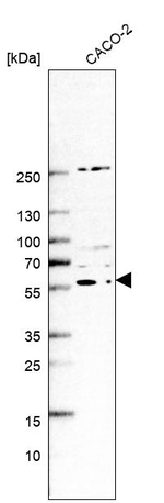 ZSWIM1 Antibody in Western Blot (WB)