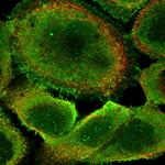 ANKEF1 Polyclonal Antibody