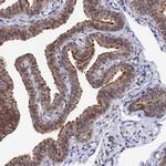 ANKEF1 Antibody in Immunohistochemistry (Paraffin) (IHC (P))