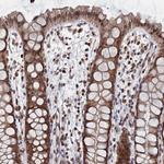 ANKEF1 Antibody in Immunohistochemistry (Paraffin) (IHC (P))