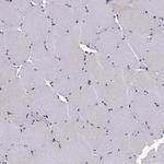 ANKEF1 Antibody in Immunohistochemistry (Paraffin) (IHC (P))