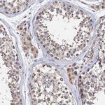 ANKEF1 Antibody in Immunohistochemistry (Paraffin) (IHC (P))