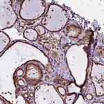 CHMP2A Antibody in Immunohistochemistry (IHC)