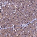 CHMP2A Antibody in Immunohistochemistry (IHC)