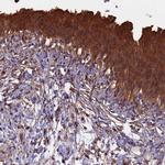 CHMP2A Polyclonal Antibody