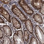 PTCD3 Antibody in Immunohistochemistry (IHC)