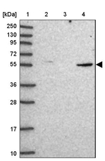 Coronin 2A Antibody in Western Blot (WB)