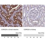Coronin 2A Antibody in Immunohistochemistry (IHC)