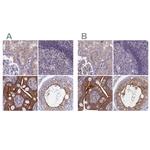 Coronin 2A Polyclonal Antibody